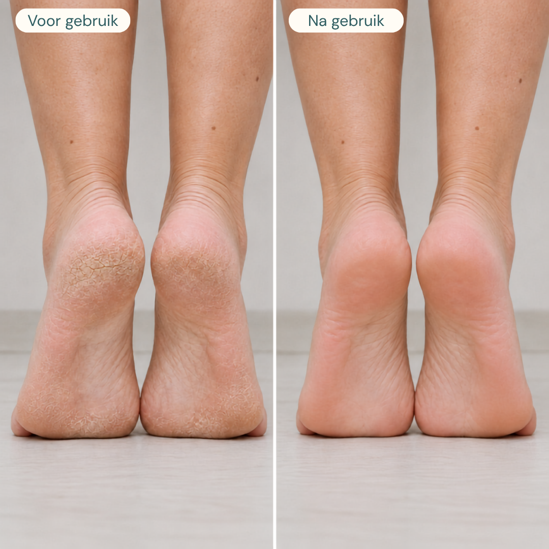 #lang_nl,be